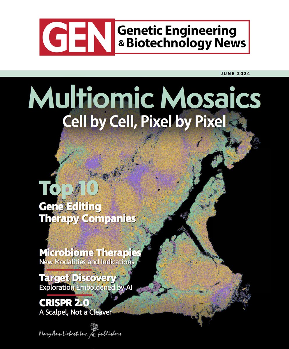 SingularGenomic's tweet image. COVER STORY! 👀👏 We are excited to see an image generated on our G4X Spatial Sequencer featured on the cover of this months @GENbio!

Check out the full article highlighting how single cell and spatial omic technologies are impacting research: genengnews.com/topics/omics/m…