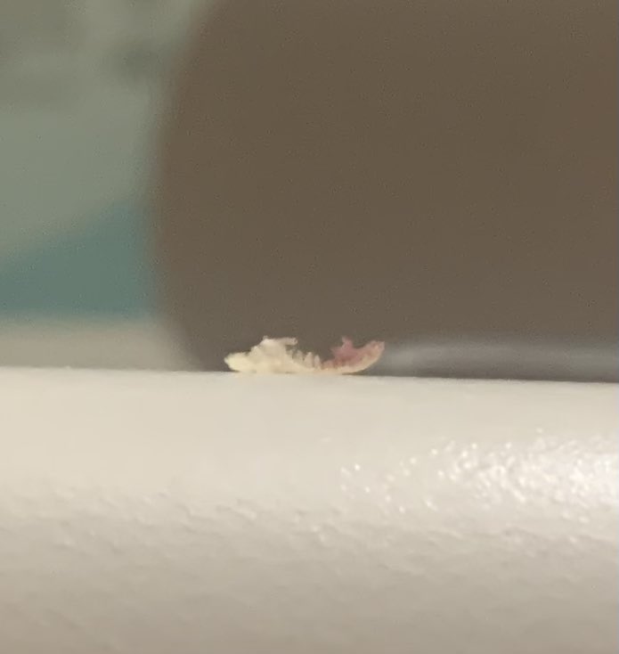 violetkathyw's tweet image. Why spikes under a scab? N the top looks like quantum dots?
#morgellons