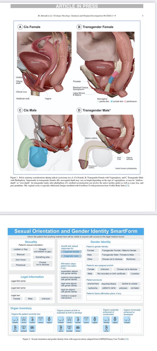 Laura Bukavina (@laurabukavinamd) on Twitter photo 📢 Excited to share our latest publication <a href="/UroOnc/">Society of Urologic Oncology</a> > multidisciplinary management of sexual&gender minorities with bladder cancer Inclusive care starts with knowing the anatomy and asking the right questions <a href="/HelenSun_MD/">Helen Sun</a> <a href="/KirtishriM/">Kirtishri Mishra</a> <a href="/shubhamdotgupta/">Shubham Gupta</a> #BladderCancer #HealthEquity 📢 Excited to share our latest publication <a href="/UroOnc/">Society of Urologic Oncology</a> > multidisciplinary management of sexual&gender minorities with bladder cancer Inclusive care starts with knowing the anatomy and asking the right questions <a href="/HelenSun_MD/">Helen Sun</a> <a href="/KirtishriM/">Kirtishri Mishra</a> <a href="/shubhamdotgupta/">Shubham Gupta</a> #BladderCancer #HealthEquity