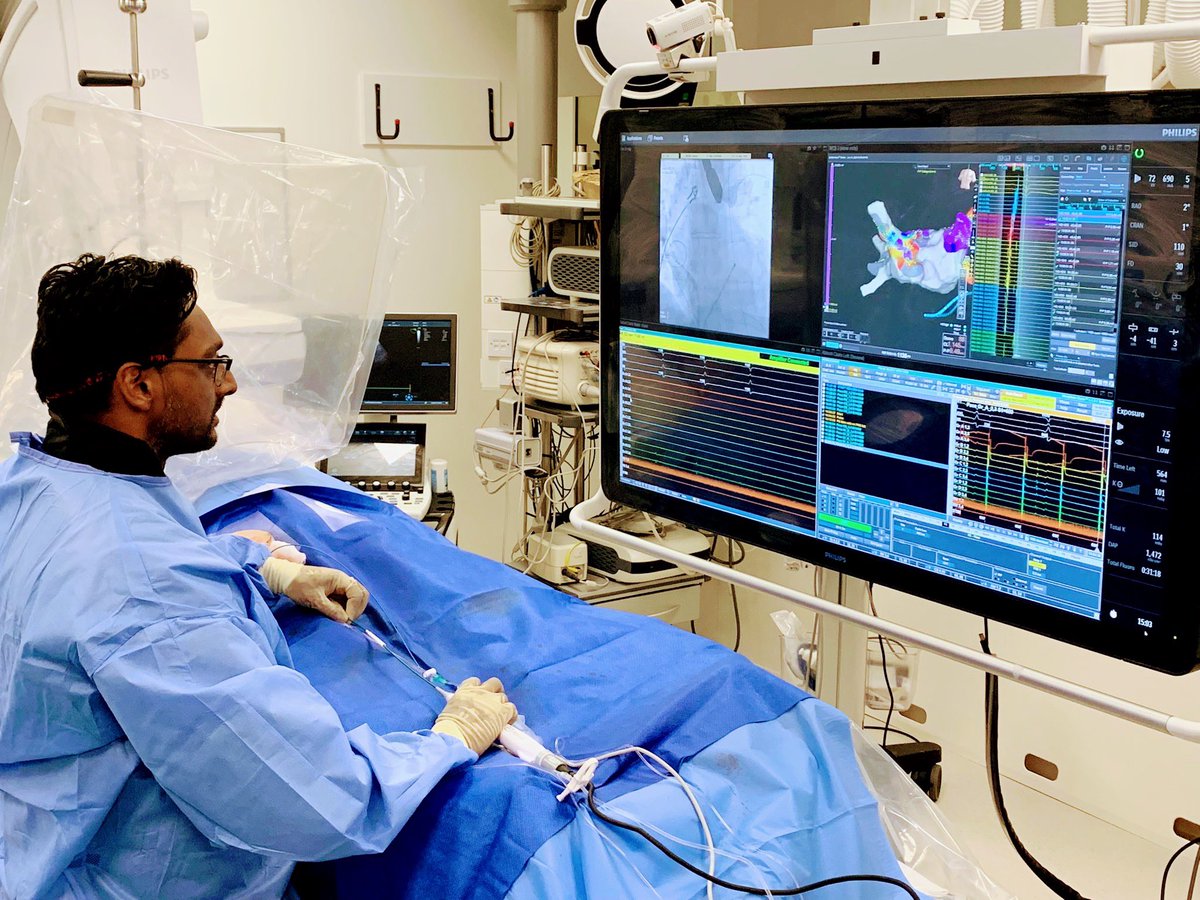 Callme_DrNeil's tweet photo. It was a privilege to perform the  FIRST PFA cases in the UK using the @MedtronicUK @Medtronic PulseSelect system @EssexCTC. Rapid pulmonary vein isolation with excellent catheter handling and the brilliant Contour sheath. Well done to our excellent lab team @MSEHospitals https://t.co/T9IgO5etsh