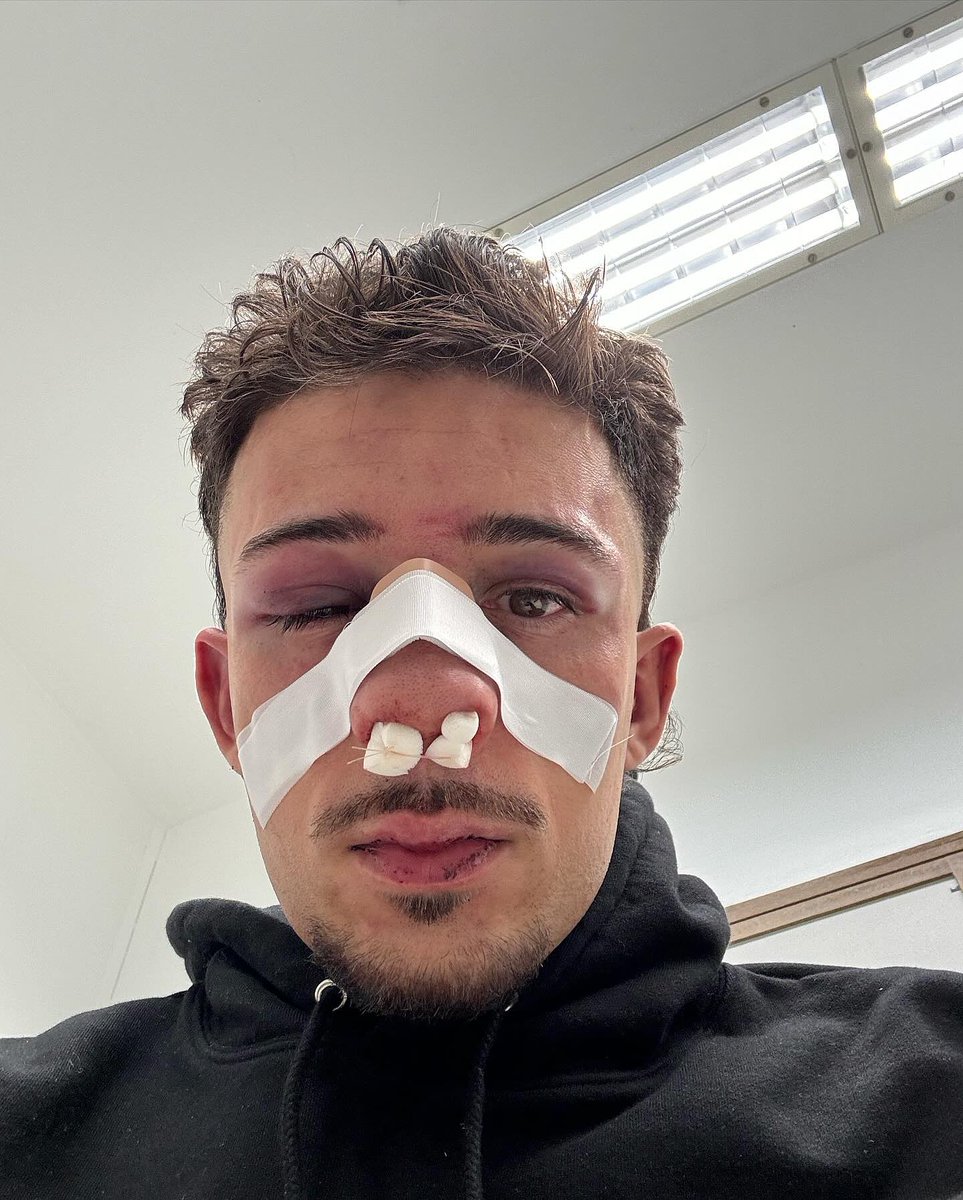 Diogo_Costa28's tweet photo. Mbappé logo à noite https://t.co/ngwTp564fv