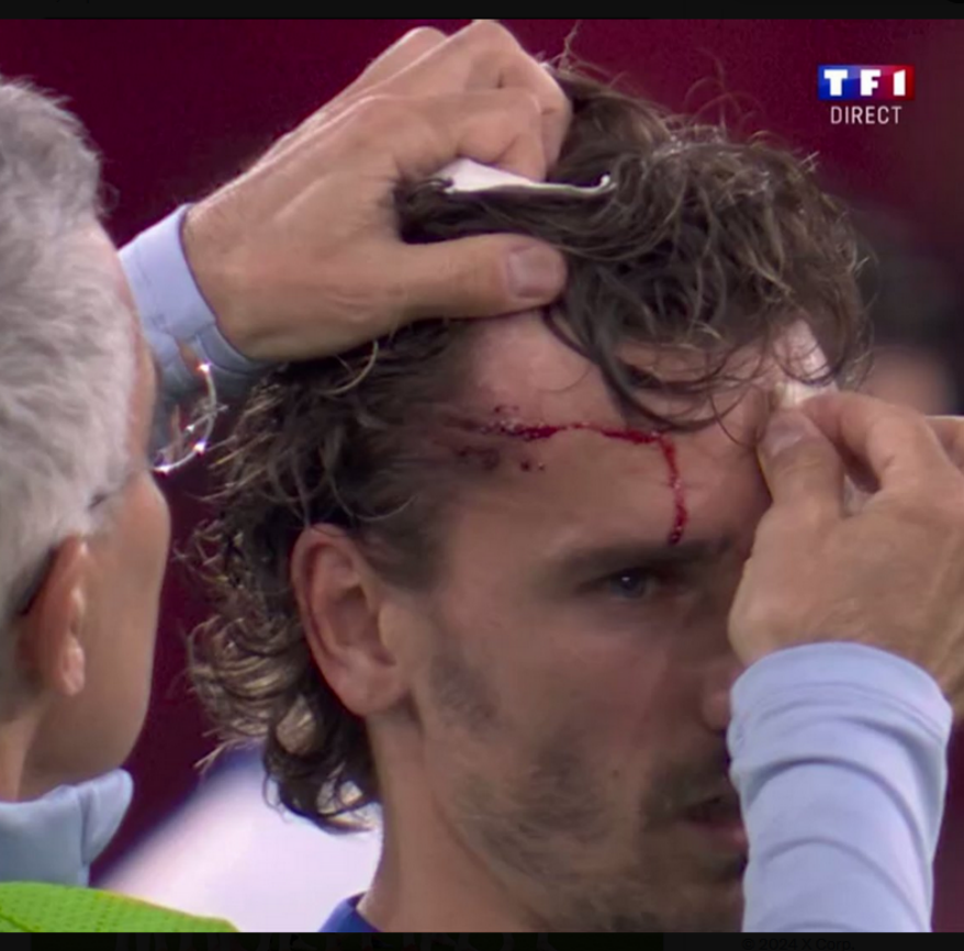 AlyumdrA's tweet photo. #EURo2024 #AUTFRA

Sympa ce France Autriche 🥴 https://t.co/eDtpF0k1B3