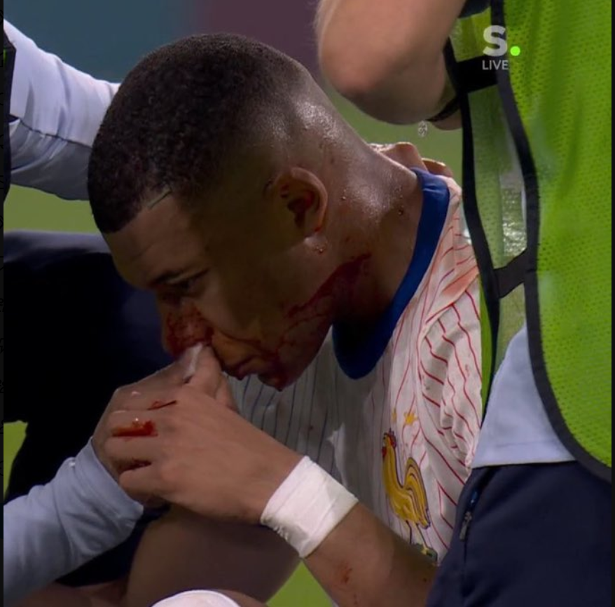 AlyumdrA's tweet photo. #EURo2024 #AUTFRA

Sympa ce France Autriche 🥴 https://t.co/eDtpF0k1B3