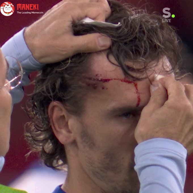 E̶u̶r̶o̶s̶ ❌ UFC ✅