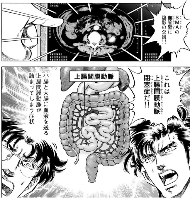 愛知の病院で高校生が誤診で亡くなってしまったというニュースが病気含めてまんまこの話だった 