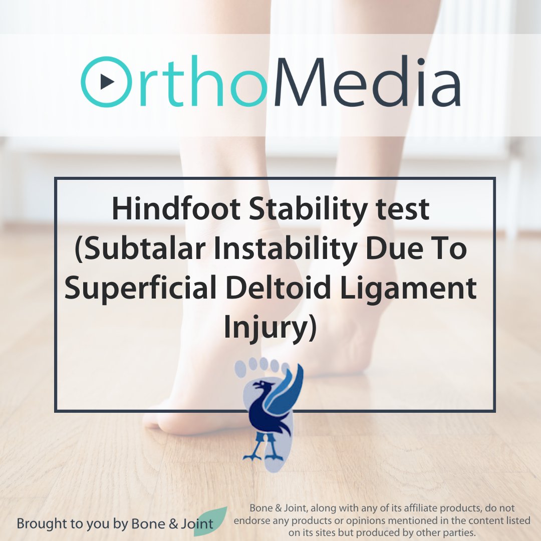 OrthoMedia (@orthomedia_) on Twitter photo The Hindfoot Stability test measures the subtalar instability due to the injury of the superficial deltoid, which causes excessive subtalar motion.
From <a href="/Liverpool_Ortho/">Liverpool Orthopaedic and Trauma Service</a>, the latest Foot and Ankle video on #OrthoMedia.
#Orthopedics #FootSurgery
ow.ly/1Rm950S9iWn The Hindfoot Stability test measures the subtalar instability due to the injury of the superficial deltoid, which causes excessive subtalar motion.
From <a href="/Liverpool_Ortho/">Liverpool Orthopaedic and Trauma Service</a>, the latest Foot and Ankle video on #OrthoMedia.
#Orthopedics #FootSurgery
ow.ly/1Rm950S9iWn