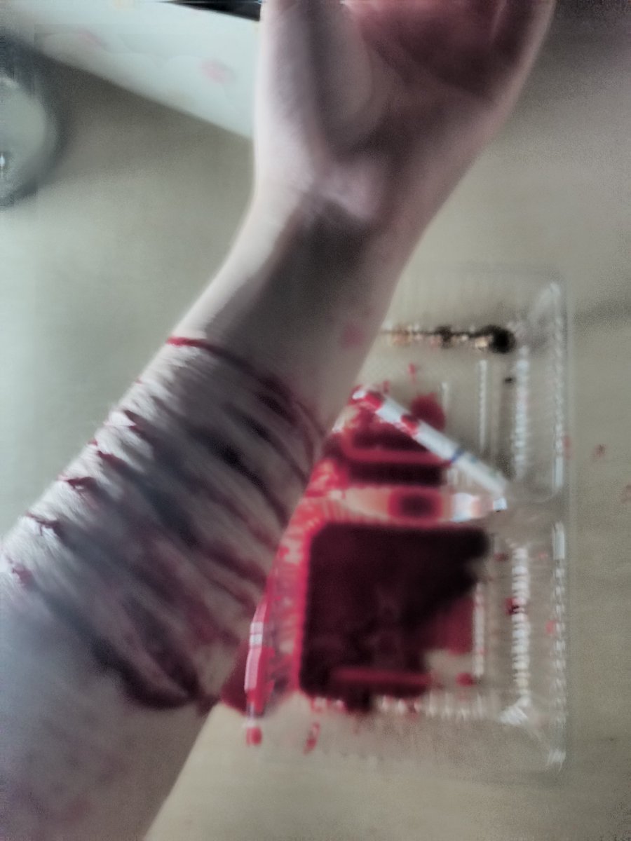 anohinok14's tweet photo. #リスカ 貴様 死ね、 https://t.co/q1E9lARzkE
