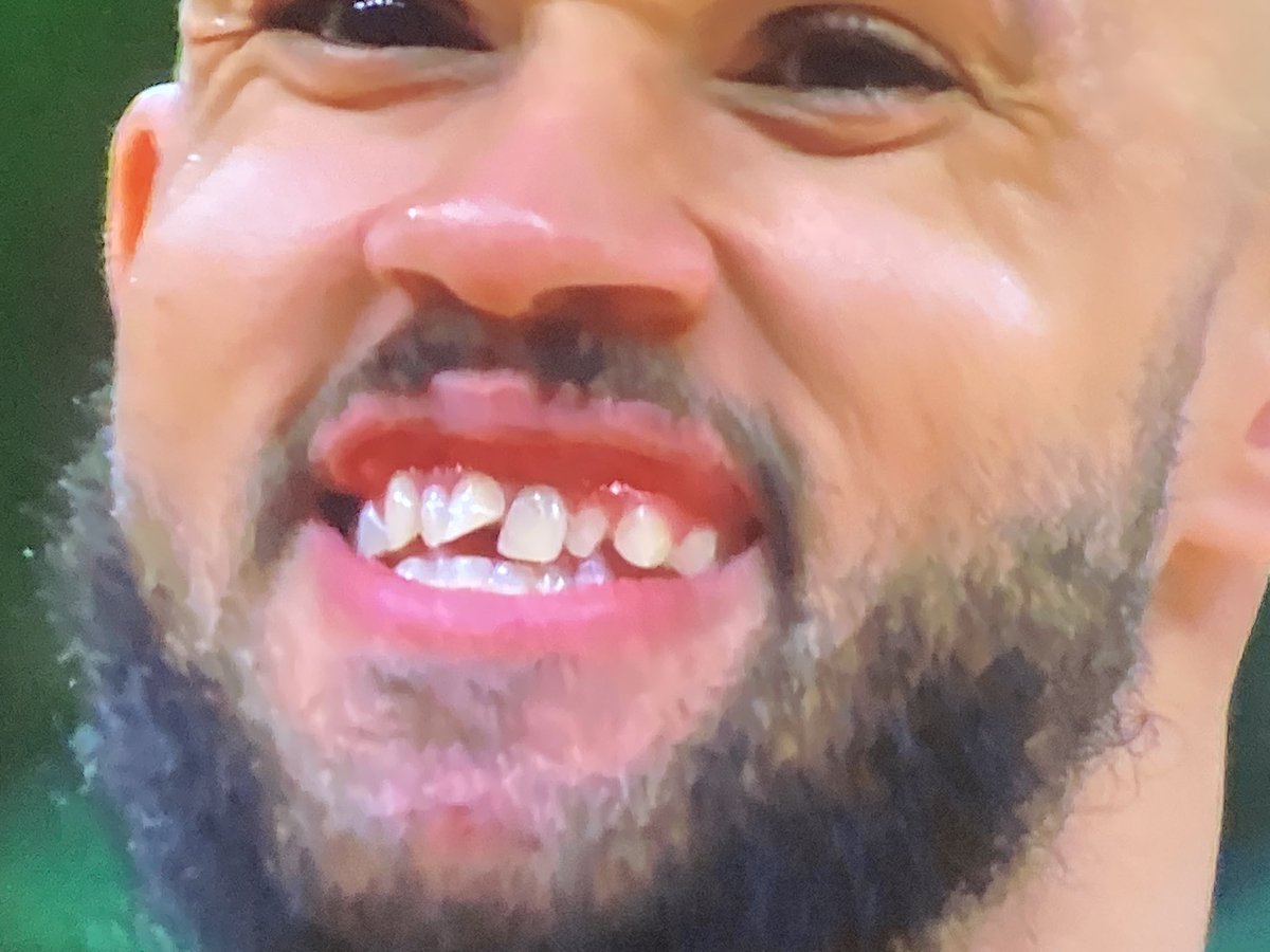 This is who I want on my team. Boston Celtics guard, Derrek White, after smashing his face smiles. #LFG #derrickwhite #bostonceltics