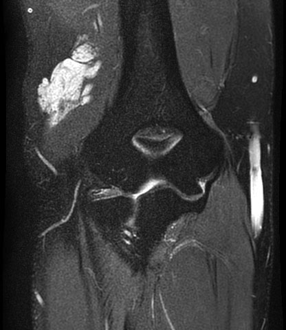 UW MSK Imaging & Intervention tweet media