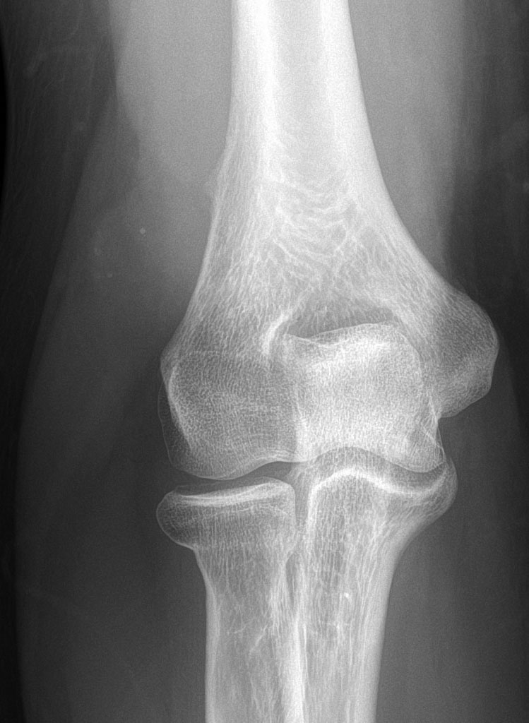 UW MSK Imaging & Intervention tweet media