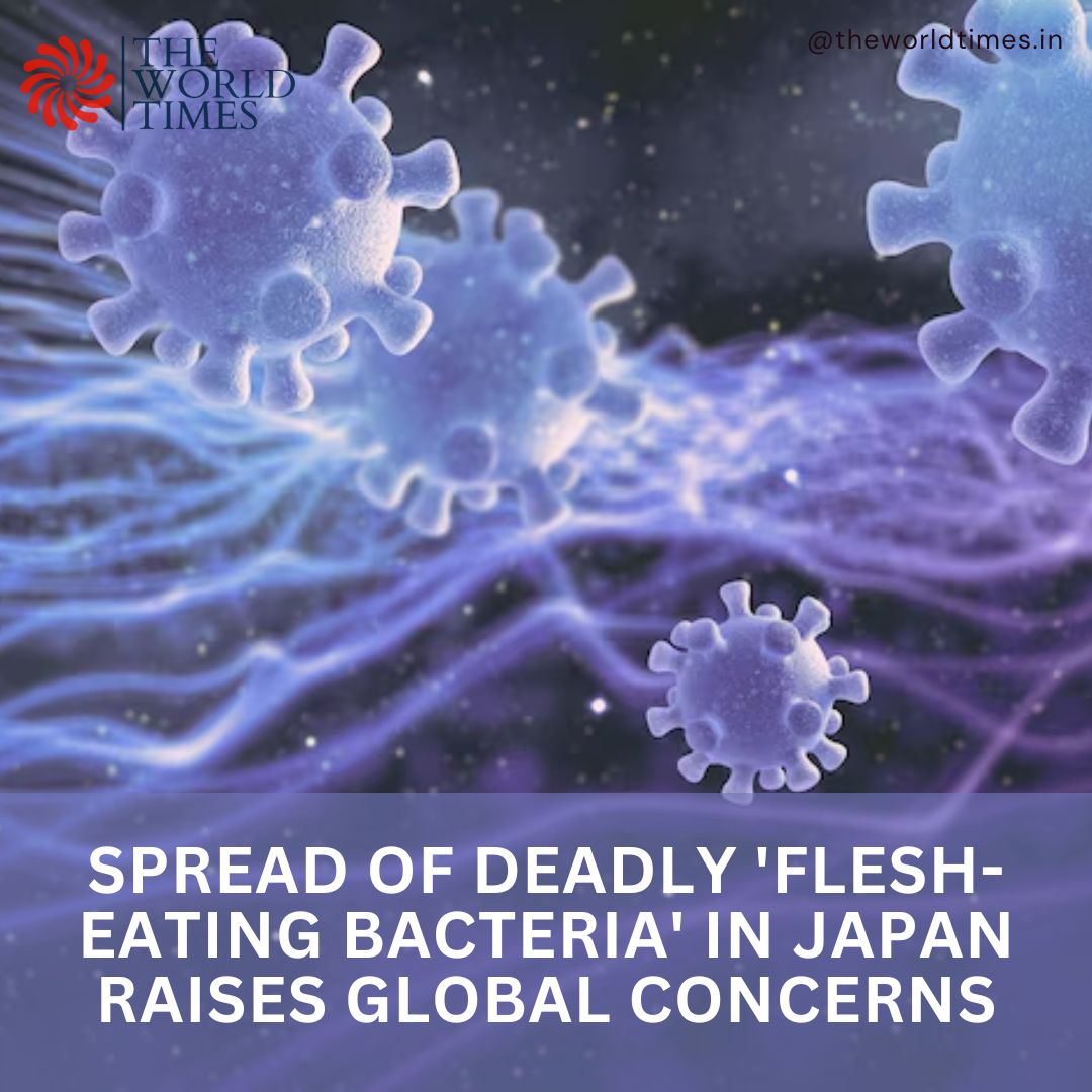 worldtimes_in's tweet photo. In the wake of the Covid-19 pandemic, humanity now faces a new threat: a flesh-eating bacterial infection known as Streptococcal Toxic Shock Syndrome (STSS). 

[virus, japan, STSS, flesh eating, bacteria]

#virus #japan #STSS #flesheating #bacteria 

Source: Business Standard https://t.co/UfhuogKTVu