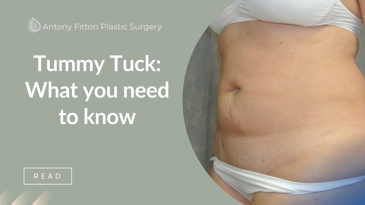 AntonyFitton's tweet photo. Are you considering a Tummy Tuck?

Here's what you need to know...
https://t.co/ZFOsWYxild 

#AntonyFitton #PlasticSurgeon #Plymouth #Truro #TummyTuck #Abdominoplasty #TummyTuckTransformation #BoostConfidence #BodyContouring #ExpertPlasticSurgeon #BodySculpting https://t.co/mtsUMhu5lG