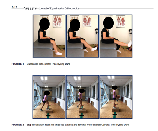 What should rehab look like after patellar stabilising surgery? doi.org/10.1002/jeo2.1…