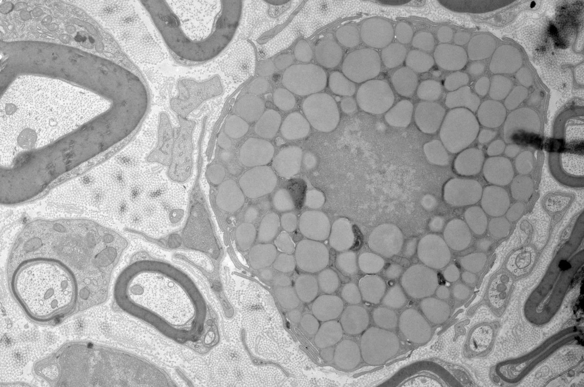 giulia_casal's tweet image. What is this cell? #ElectronMicroscopy