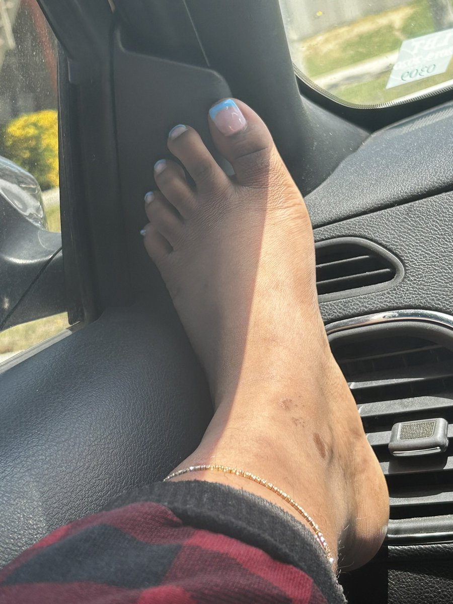 SweetHxney23's tweet photo. Come Suck On My Toes 💋💋
#SexyTime
#TricksOnly https://t.co/ES1HTgIHNA