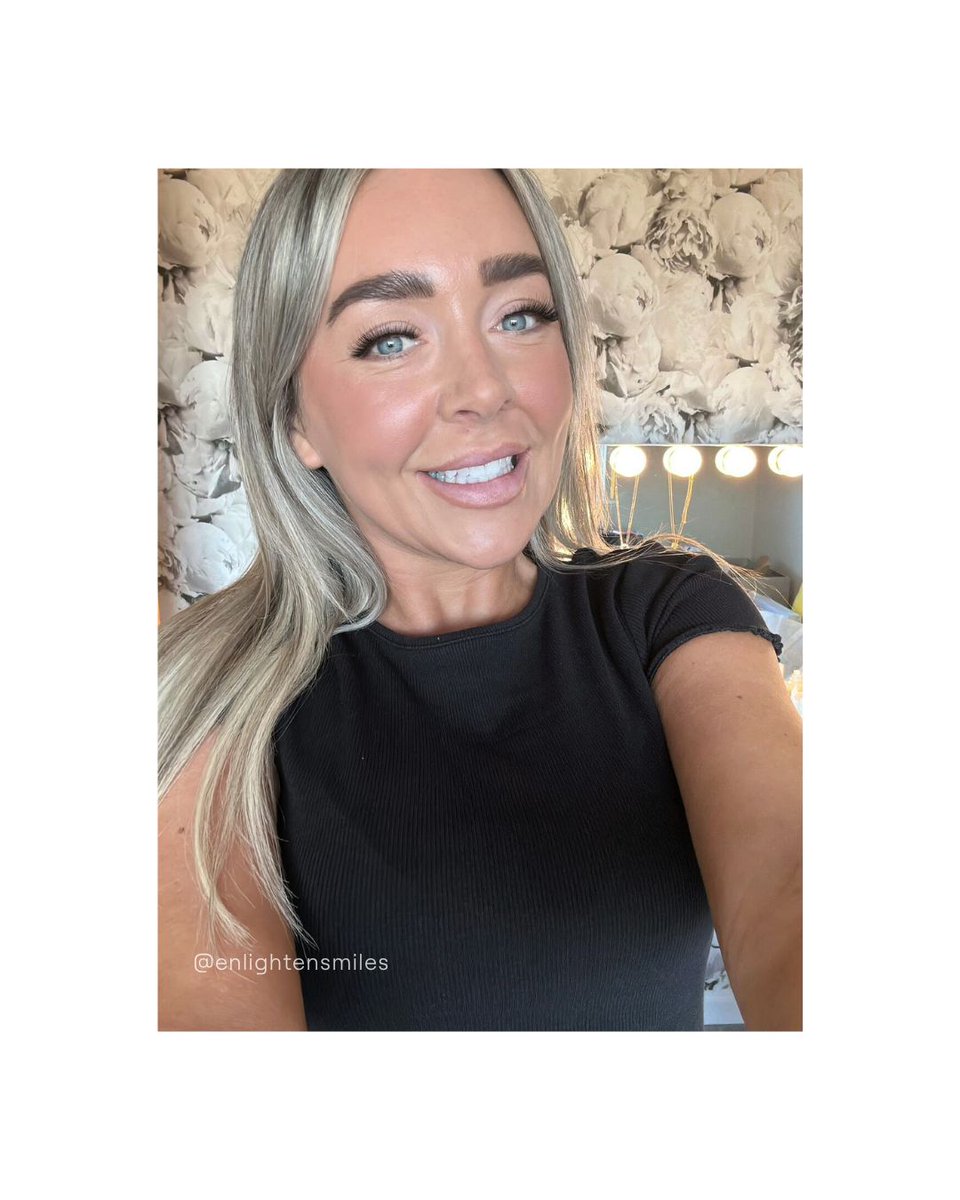 Check out this amazing bright smile from one of our lovely customers! 🤳🏼✨

We love seeing your results, so don’t forget to tag us in your smile selfies! 😘

#enlightencustomer #enlightenselfie #whitesmile #newsmile #teethwhitening #whitening