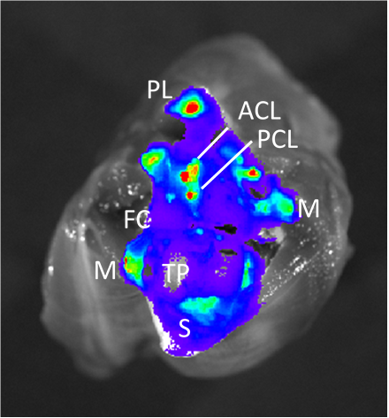 Bonassar Lab (@bonassarlab) on Twitter photo Congratulations to <a href="/FortinAiyana/">Aiyana Fortin</a> for her runner-up award in the PhD student paper competition at #sb3c2024 demonstrating extended joint residence time and chondrocyte internalization of CāDots for #osteoarthritis therapy. #CornellBME #CornellMSE Congratulations to <a href="/FortinAiyana/">Aiyana Fortin</a> for her runner-up award in the PhD student paper competition at #sb3c2024 demonstrating extended joint residence time and chondrocyte internalization of CāDots for #osteoarthritis therapy. #CornellBME #CornellMSE