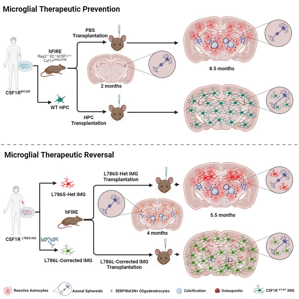 I am excited to share our new study from the <a href="/BlurtonJonesLab/">Blurton-Jones Lab</a>  "Therapeutic potential of human microglial transplantation in a chimeric model of CSF1R-related leukoencephalopathy" <a href="/NeuroCellPress/">Neuron</a> sciencedirect.com/science/articl…