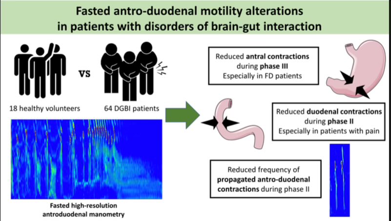 John Damianos, M.D. (@john_damianosmd) on Twitter photo Patients with disorders of gut-brain interaction demonstrate abnormal antroduodenal motility. 
#MedTwitter #GITwitter #motility #DGBI 
journals.physiology.org/doi/abs/10.115… Patients with disorders of gut-brain interaction demonstrate abnormal antroduodenal motility. 
#MedTwitter #GITwitter #motility #DGBI 
journals.physiology.org/doi/abs/10.115…