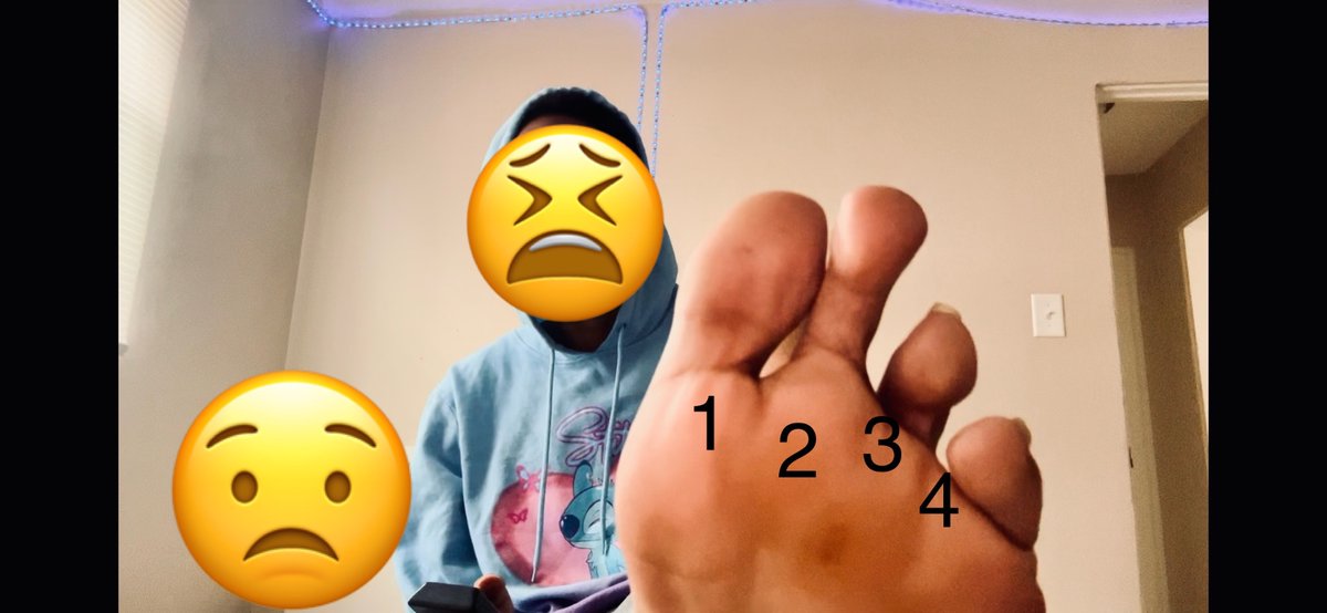 iAMkiddBEAST's tweet image. I only got 4 toes!! 🤦🏽‍♂️🤦🏽‍♂️

youtu.be/VjnuneEvO1Q?si…