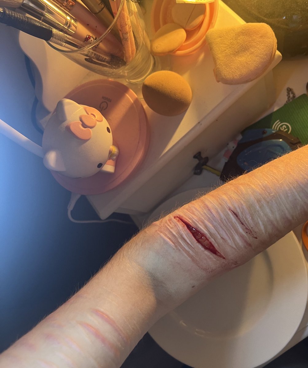 v4mq4's tweet photo. finally stopped bleeding after 3 hours.. https://t.co/RTFzplulTS