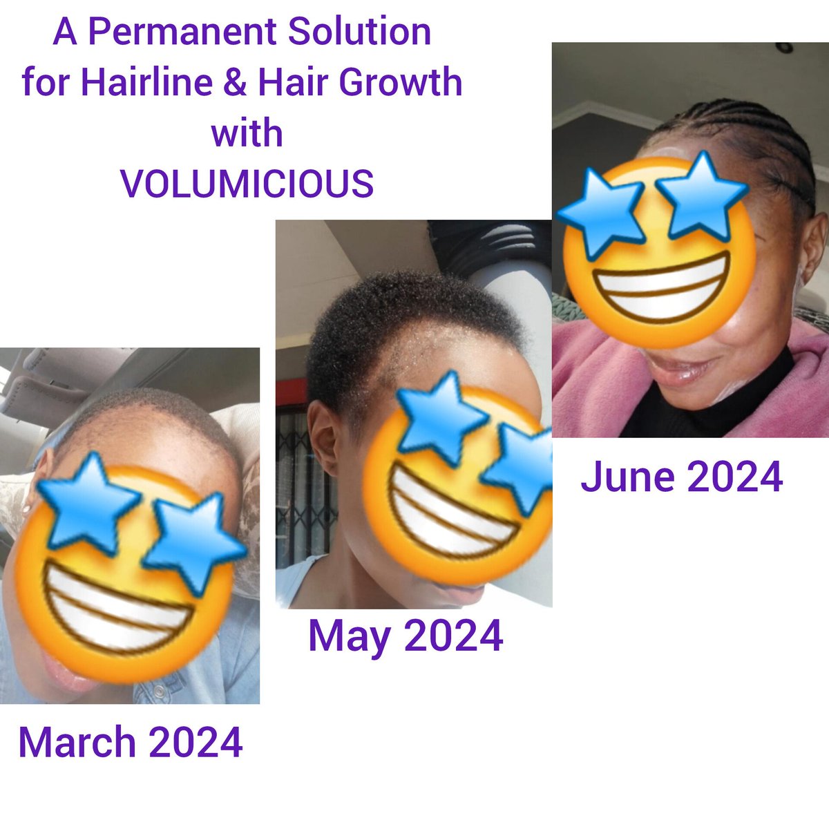 I have the plug for ALL your Hair Problems 😍

By December you can have an AFRO 👌🏽🙌🏽

Start Now🙋🏾‍♀️

 076 124 2375