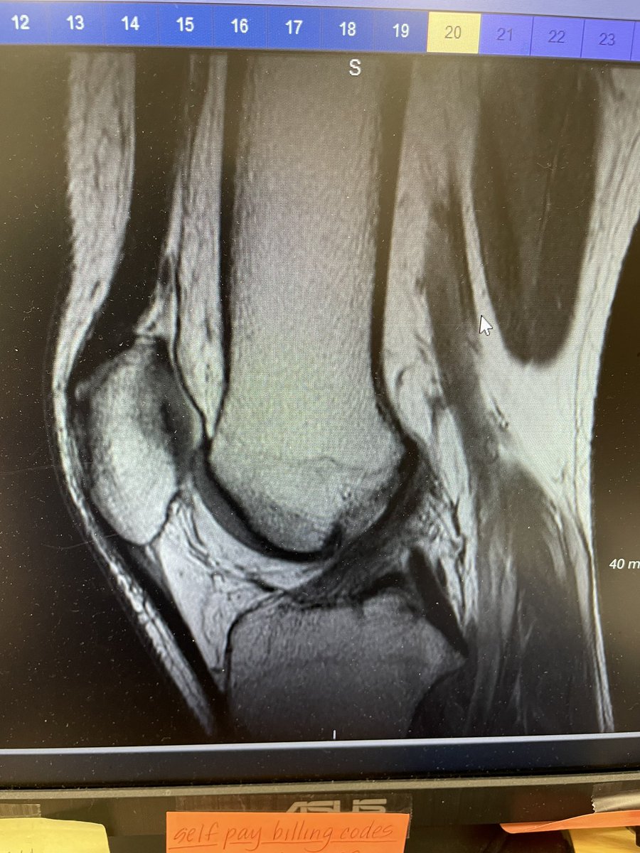 It can happen.  
Trust the process.