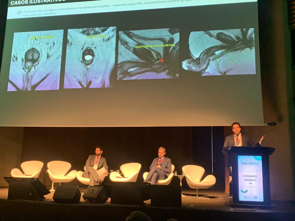 Fernando Morbeck Coelho, MD, PhD (@morbeckfernando) on Twitter photo #urousp2024
I want to thank the invitation to speak about MR Urethrography at the 7th USP Urology Congress.
#radiology #urology #MRI 🤝🤝
<a href="/FMUSPoficial/">FMUSP - Oficial</a> <a href="/Urologia_USP/">Urologia USP</a> #urousp2024
I want to thank the invitation to speak about MR Urethrography at the 7th USP Urology Congress.
#radiology #urology #MRI 🤝🤝
<a href="/FMUSPoficial/">FMUSP - Oficial</a> <a href="/Urologia_USP/">Urologia USP</a>