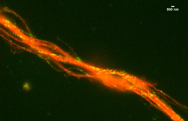 Subhojit Roy, MD, PhD tweet media