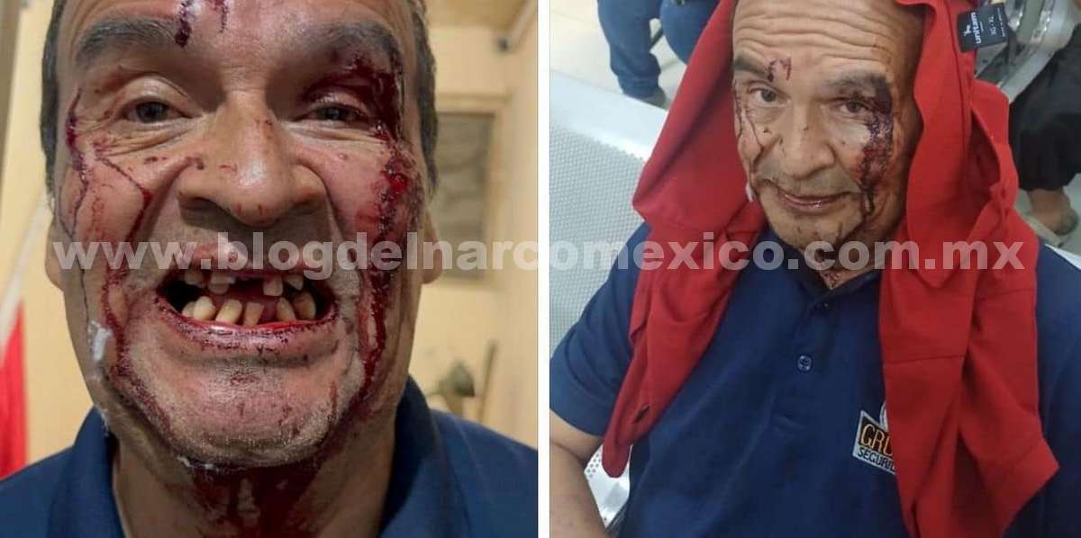 blogdelnarcomx's tweet photo. Saltillo, Coahuila: Así fue como un infeliz y cobarde Abogado de Nombre José Luis Dena fue exhibido en redes sociales propinando una golpiza a don Pedro, un vigilante de 72 años que pidió al abogado que ingresara al fraccionamiento por la puerta correcta  https://t.co/A8ZRGBBsix https://t.co/XpR0HzdXeZ
