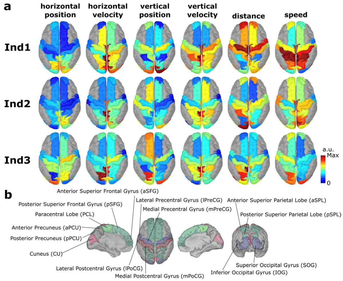 Sensors_MDPI's tweet image. Transfer Learning in Trajectory Decoding: Sensor or Source Space?
mdpi.com/1424-8220/23/7…
@tugraz 
#electroencephalography; #braincomputerinterface; #sourcelocalization