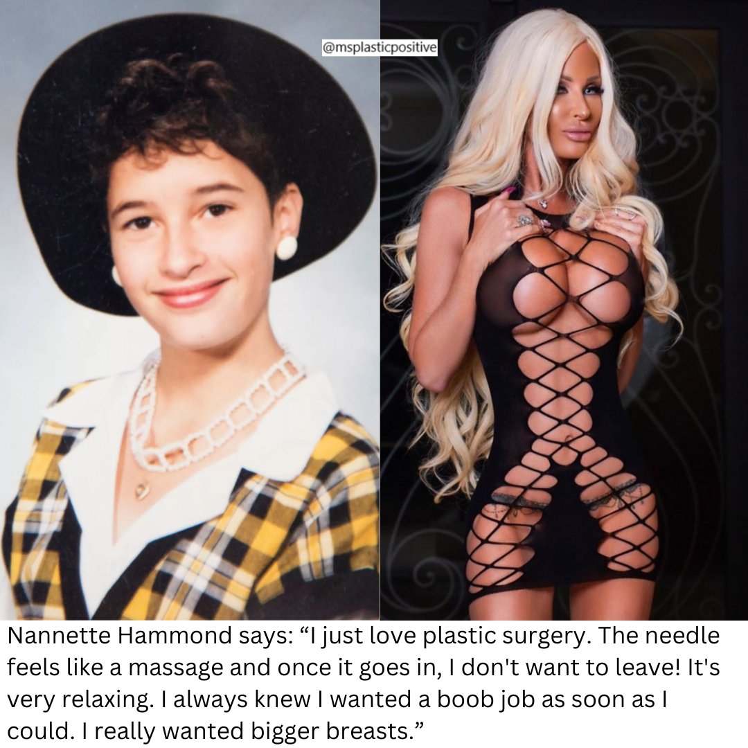 plastic_ms's tweet image. IG: nannettehammondloschiavo #plasticsurgery #cosmeticsurgery #bimbogirl #bimbobarbie #bimbo #bimbogoddess #BreastAugmentation #bigboobs #plasticlife #plasticdoll #plasticmakesperfect