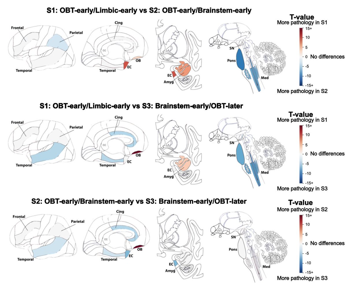 Disease progression modelling reveals heterogeneity in trajectories of Lewy-type α-synuclein pathology

<a href="/SEMastenbroek/">Sophie Mastenbroek</a> strikes again!

Using SuStaIn modeling of neuropathological data (n=814) we show substantial heterogeneity in the temporal spread of Lewy body pathology, with