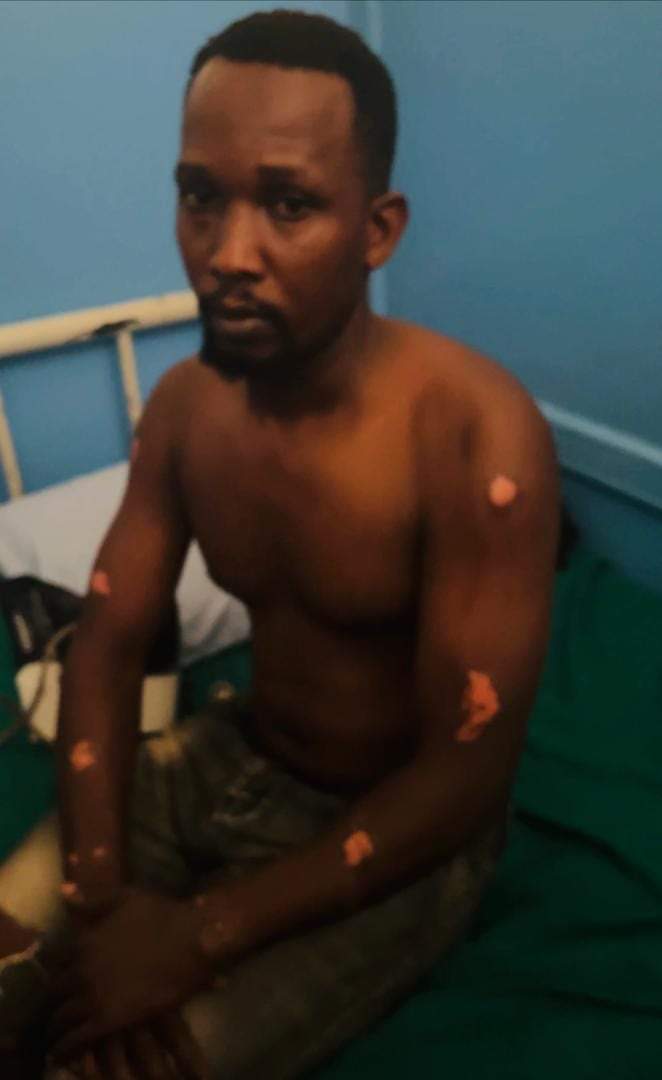 HEBobiwine's tweet photo. This is Mayega Ronald, one of our comrades being tried by the Military Court alongside Olivia Lutaaya and others. He is one of the four who were released on bail, and have been persistently approached by state operatives asking them to 'cooperate with the state' and implicate themselves as having committed the crimes they're charged with. 

On 11th June, he did not return home and his family reported to us about his disappearance. They also reported a case of Disappearance with the Police. For over a week, our Human Rights team alongside his family have been looking for him everywhere including police stations. 

This morning, he resurfaced bearing gruesome wounds. He says that he was abducted by heavily armed men on Tuesday last week. According to his account, they took him to an unknown place where they interrogated him about the ongoing case at the military court, asking him why he has refused to cooperate with them. They asked him why he has repeatedly refused to implicate me and other NUP leaders as having sent them to commit crimes. They tasked him to admit that he committed the offences at the military court and apologize to Gen. Museveni. They promised that if he remains adamant, he will face dire consequences, and if he accepts, he will be given monetary favors. 

Very sadly, he says that two of his captors sodomized him and promised to kill him if he spoke about it😡 (A medical doctor has examined him and confirmed that he was indeed sexually abused)! They would later subject him to untold torture as seen in these pictures. His arms bear clear marks of having been on handcuffs. 

A very sad state of affairs! This is why we cannot give up our pursuit for justice and accountability for these crimes against humanity!