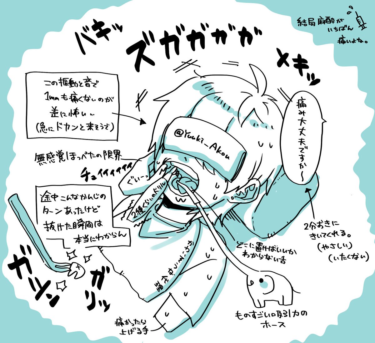 今日、右上下2本の親知らずを抜歯してきました!!🦷🥹🦷
完全な横向きなのでビビり散らかしてたんですが、入念な麻酔のおかげでいつ抜けたかもわからない見事な抜歯でした〜!
2本同時で正解かも✨
まだ初日で腫れが無いので、今後が楽しみ(?)です。