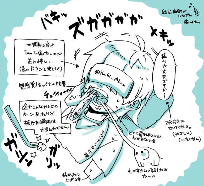 今日、右上下2本の親知らずを抜歯してきました!!🦷🥹🦷

完全な横向きなのでビビり散らかしてたんですが、入念な麻酔のおかげでいつ抜けたかもわからない見事な抜歯でした〜!
2本同時で正解かも✨

まだ初日で腫れが無いので、今後が楽しみ(?)です。 