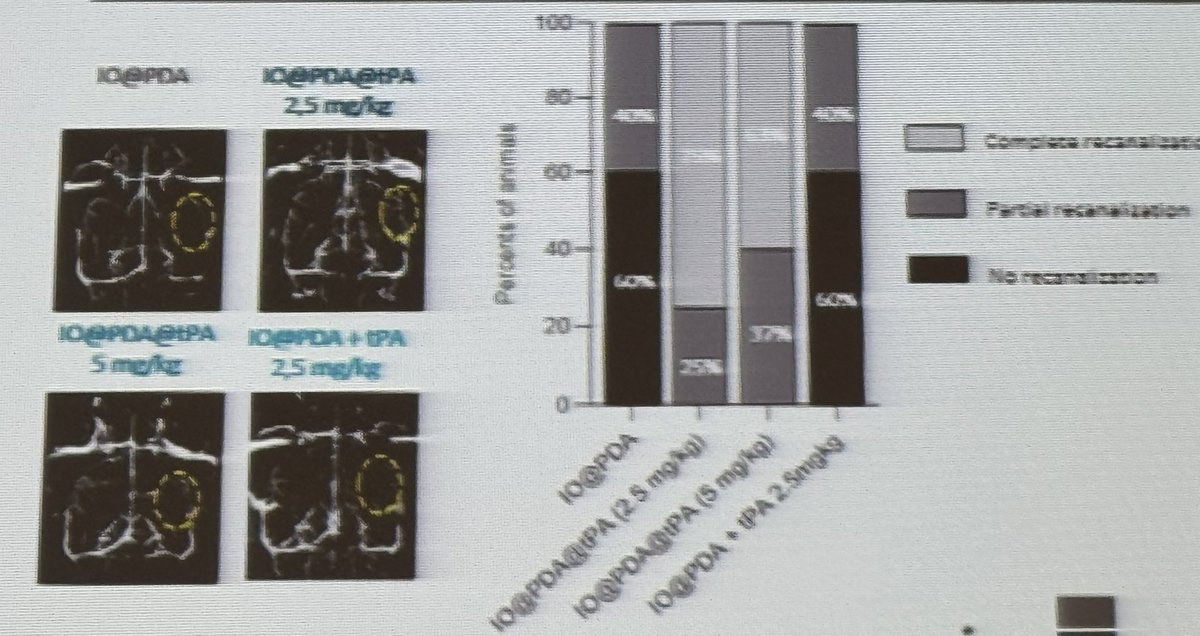 Sara Martinez de Liz (@s_martinezdeliz) on Twitter photo ...& we continue with <a href="/Audrey_picot/">Audrey Picot</a>'s comprehensive talk about the new #theranostic tool to diagnose and treat microthrombi after #stroke 🧠🌑💉🔥🥰#TheFutureofMolecularMR ...& we continue with <a href="/Audrey_picot/">Audrey Picot</a>'s comprehensive talk about the new #theranostic tool to diagnose and treat microthrombi after #stroke 🧠🌑💉🔥🥰#TheFutureofMolecularMR