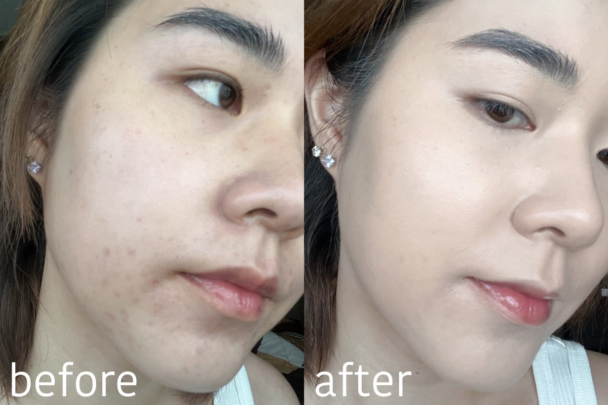 nninitecha's tweet photo. แปะเพิ่ม before - after ให้ดู เรามีสิวและรอยสิว มันปิดกริบมาก ไม่ต้องใช้ concealer เลยอะ 

พิกัด สีใหม่ : https://t.co/Urt6II0AwX https://t.co/nxaBNm79HK