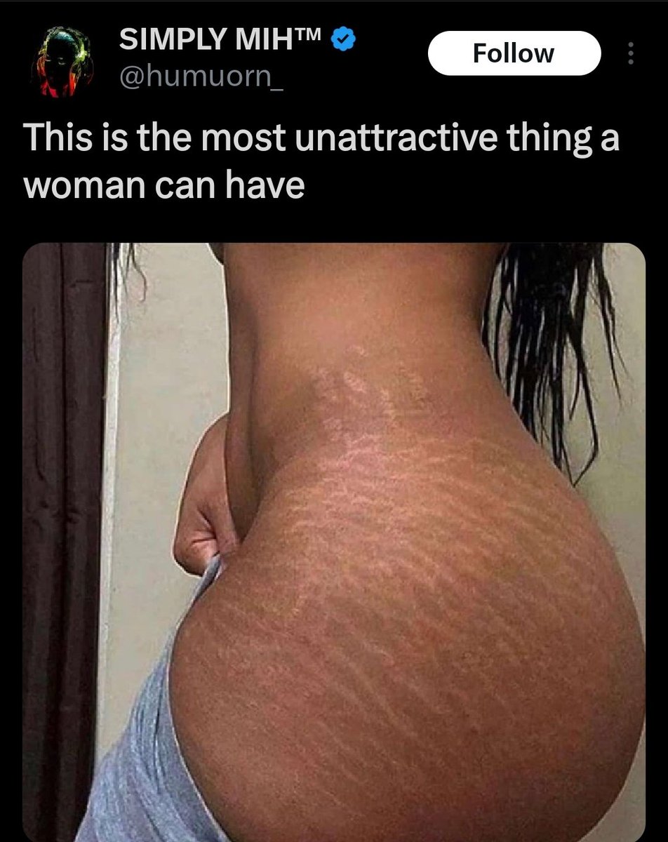 ZOrtiz99's tweet image. Hey men, is this true?