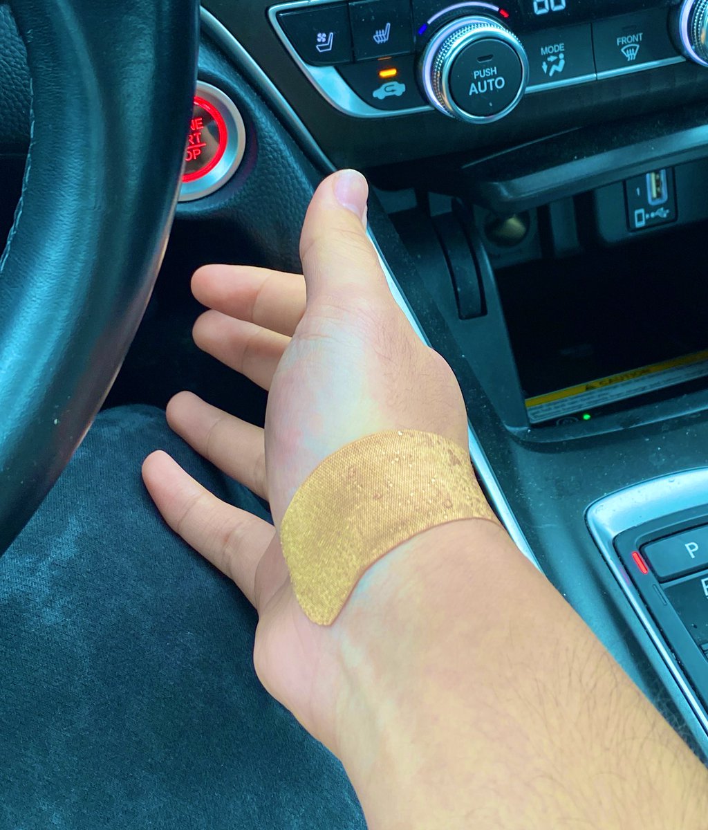 six months in, finally got an injection

hopefully hand recovers and i can fully use it again soon