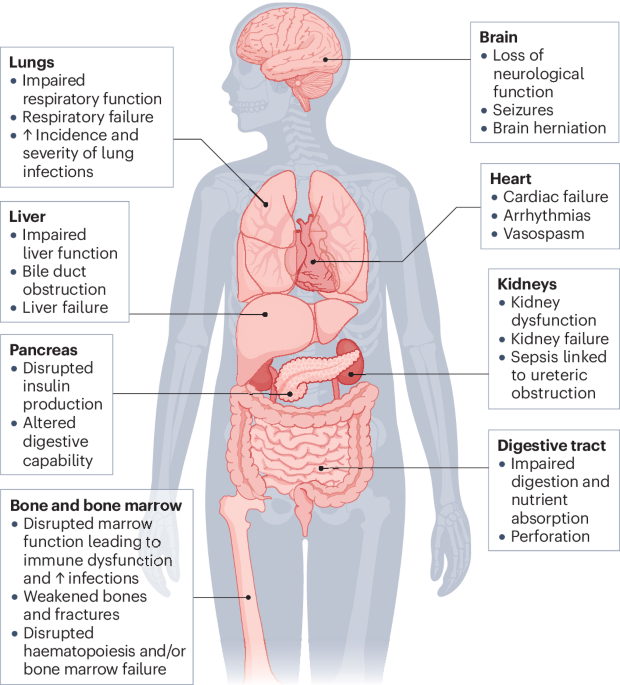 NatureRevCancer's tweet photo. NEW content online! Why do patients with cancer die? https://t.co/xY6phQO7fa https://t.co/IrZzibNpoW