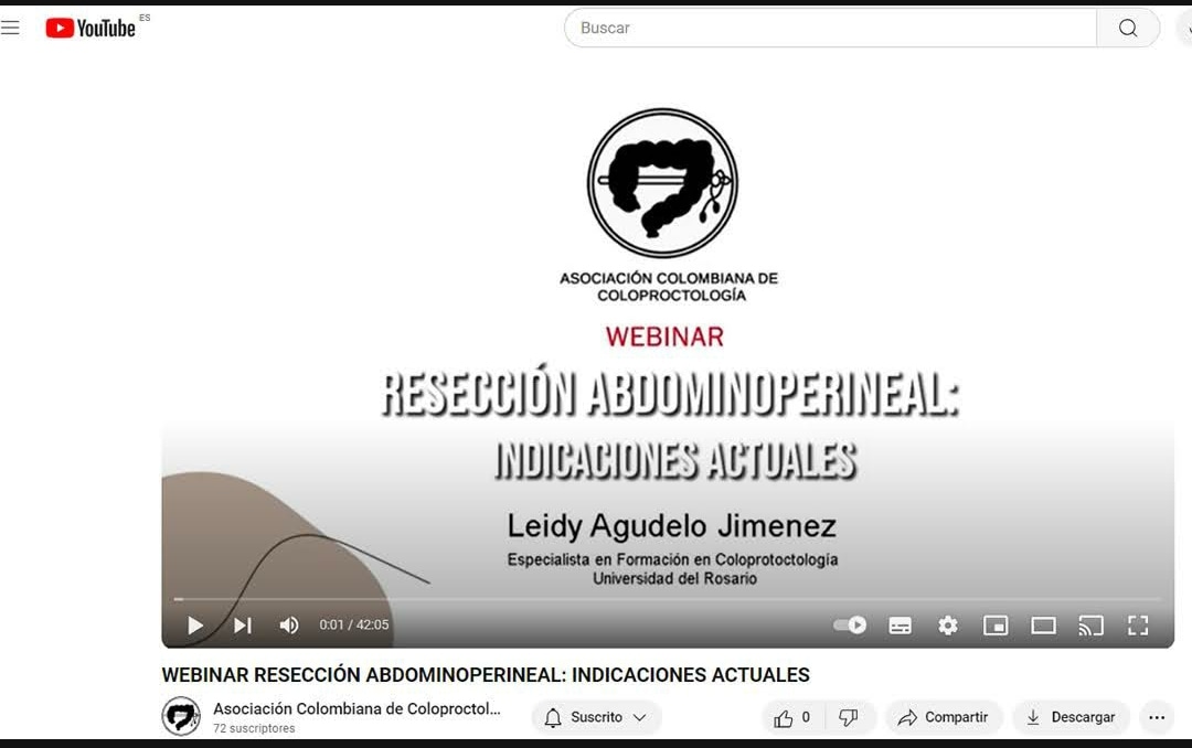 Ya esta en nuestro Canal de Youtube @AsociacionColombianadeColoproctologia
el video del WEBINAR RESECCIÓN ABDOMINOPERINEAL: INDICACIONES ACTUALES. Leidy Agudelo Jiménez,Especialista en Formación en Coloproctología
Universidad del Rosario 
Ver aquí: youtube.com/watch?v=1izJV5…