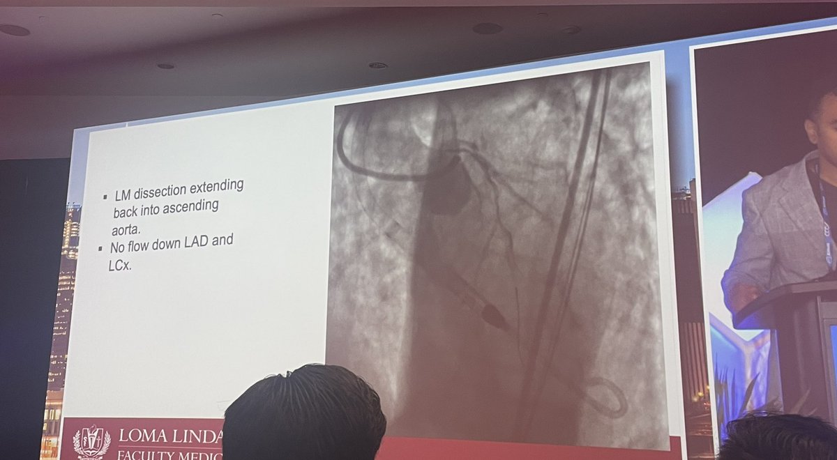 Great discussion and live cases at <a href="/CCCSymposium_NY/">CCC Symposium</a> and interventional fellows board review <a href="/MountSinaiHeart/">Mount Sinai Fuster Heart Hospital</a>. Review of details of DanGer Shock in Escalation&amp;weaning strategies. Divided opinions on Prevent (to revasc or not vulnerable plaque. Complication’s session was crucial!