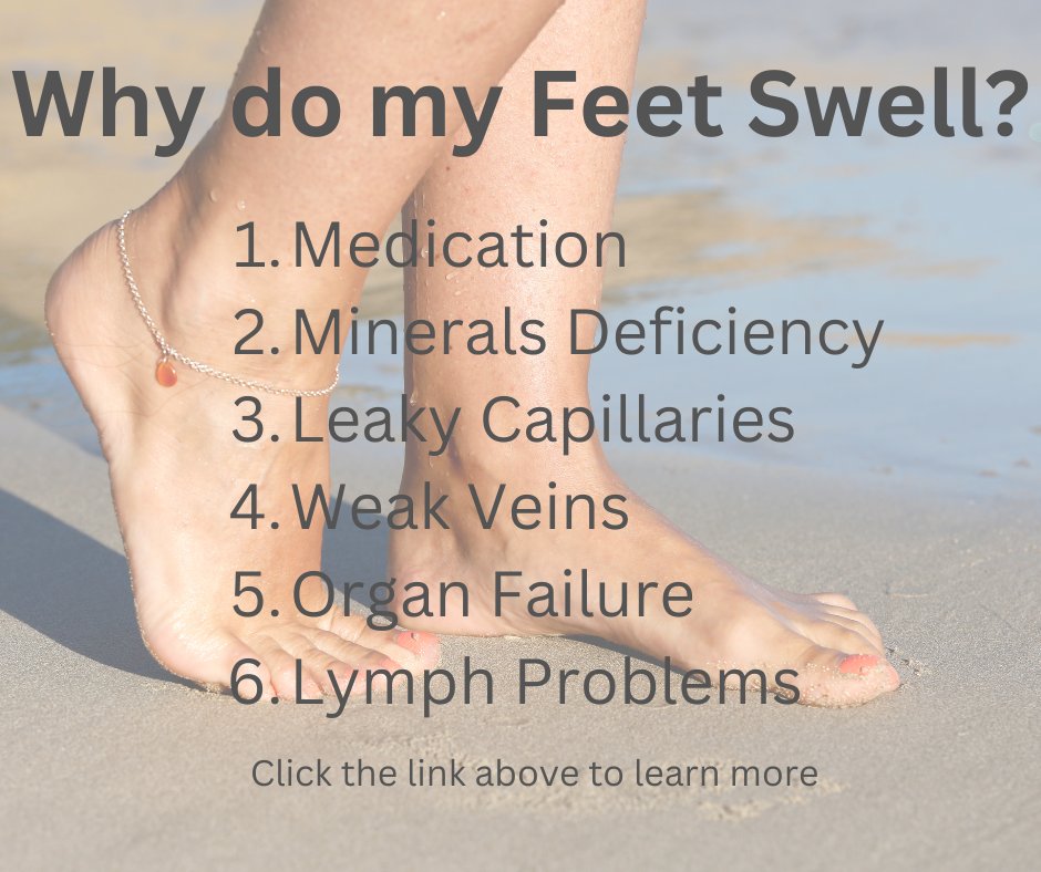MannaHealthSA's tweet photo. Oedema happens when too much fluid builds up in the body tissues, mostly in the feet and ankles – causing them to swell up. 
#Oedema  #BREAKOUT https://t.co/ABlWU4r4En https://t.co/dozKu4EKbp