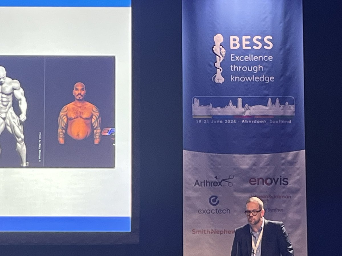 Anthony Howard (@dranthonyhoward) on Twitter photo Great presentation <a href="/samvollans/">Sam Vollans</a> on chronic reconstruction of biceps/triceps rupture <a href="/bessconference/">British Elbow & Shoulder Society</a> <a href="/LeedsUpperLimb/">LULU</a> <a href="/LeedsHospitals/">Leeds Teaching Hospitals</a> Great presentation <a href="/samvollans/">Sam Vollans</a> on chronic reconstruction of biceps/triceps rupture <a href="/bessconference/">British Elbow & Shoulder Society</a> <a href="/LeedsUpperLimb/">LULU</a> <a href="/LeedsHospitals/">Leeds Teaching Hospitals</a>