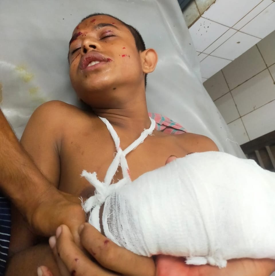 শার্শায় কুড়িয়ে পাওয়া ককটেল বিস্ফোরণে দুই শিশু আহত