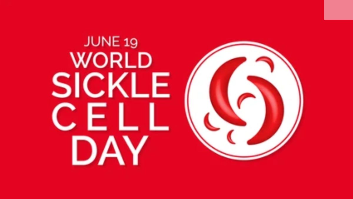sickle cell chhattisgarh (@sicklecell_cg) on Twitter photo Wishing you all happy world Sickle cell Awareness day
The theme for this year's observance is "Hope Through Progress: Advancing Sickle Cell Care Globally."
Raising awareness can save lives ЁЯЩП тЭдя╕П take action be a caregiver
#SickleCellWarriors #warriors #awareness <a href="/IndiaNasco/">NASCO India SCD Alliance</a> Wishing you all happy world Sickle cell Awareness day
The theme for this year's observance is "Hope Through Progress: Advancing Sickle Cell Care Globally."
Raising awareness can save lives ЁЯЩП тЭдя╕П take action be a caregiver
#SickleCellWarriors #warriors #awareness <a href="/IndiaNasco/">NASCO India SCD Alliance</a>