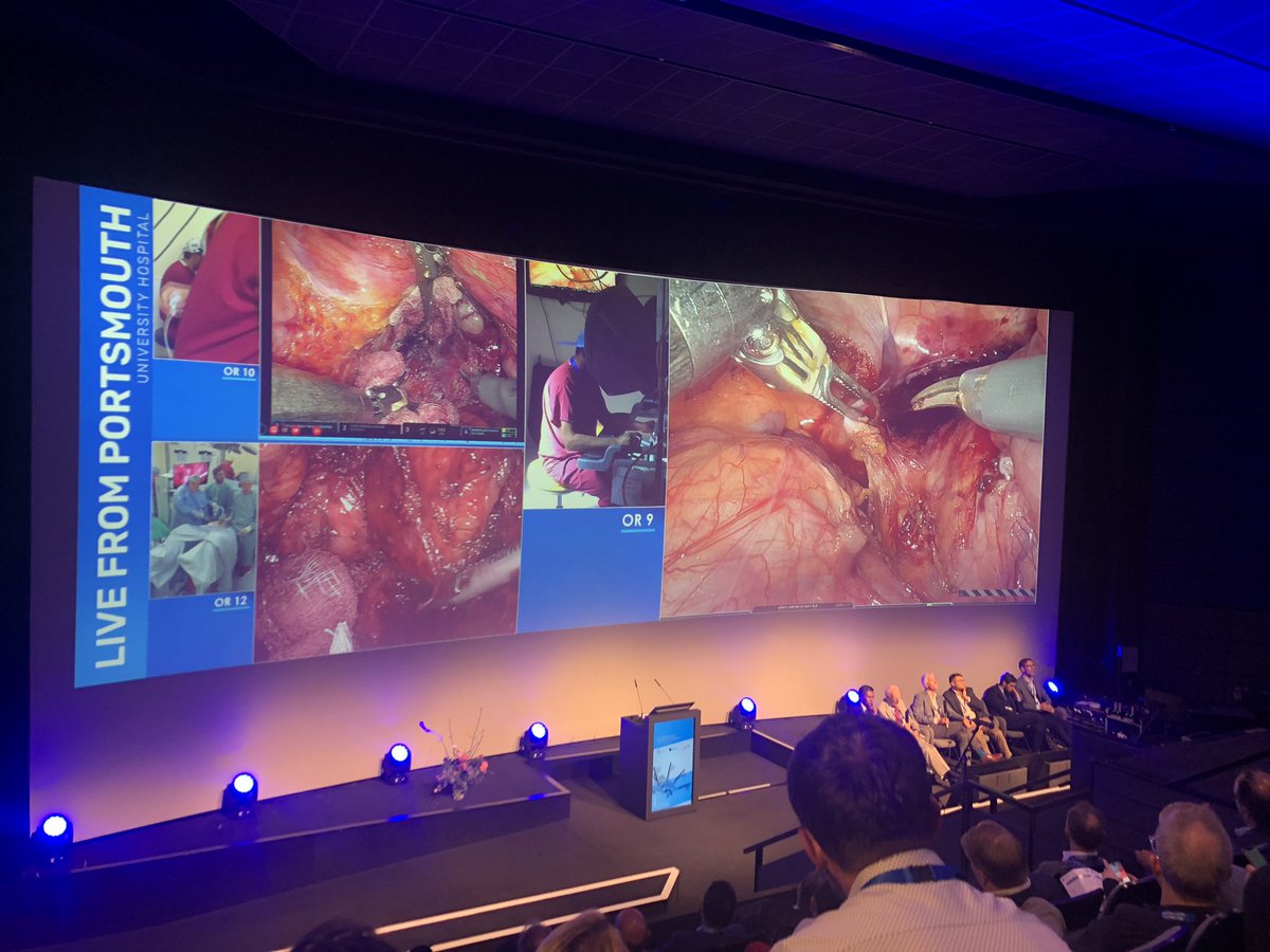 Muhammad Rafaih Iqbal (@mriqbalsurg) on Twitter photo Masterclass live #robotic 🤖 low anterior resection by <a href="/ishaikh4/">Irshad Shaikh</a> at #PCC24 <a href="/PColorectal/">Portsmouth Colorectal</a>
Some great tips and tricks on splenic flexure mobilization
🔑
➡️ Know the anatomy
➡️ Remember the embrological planes Masterclass live #robotic 🤖 low anterior resection by <a href="/ishaikh4/">Irshad Shaikh</a> at #PCC24 <a href="/PColorectal/">Portsmouth Colorectal</a>
Some great tips and tricks on splenic flexure mobilization
🔑
➡️ Know the anatomy
➡️ Remember the embrological planes