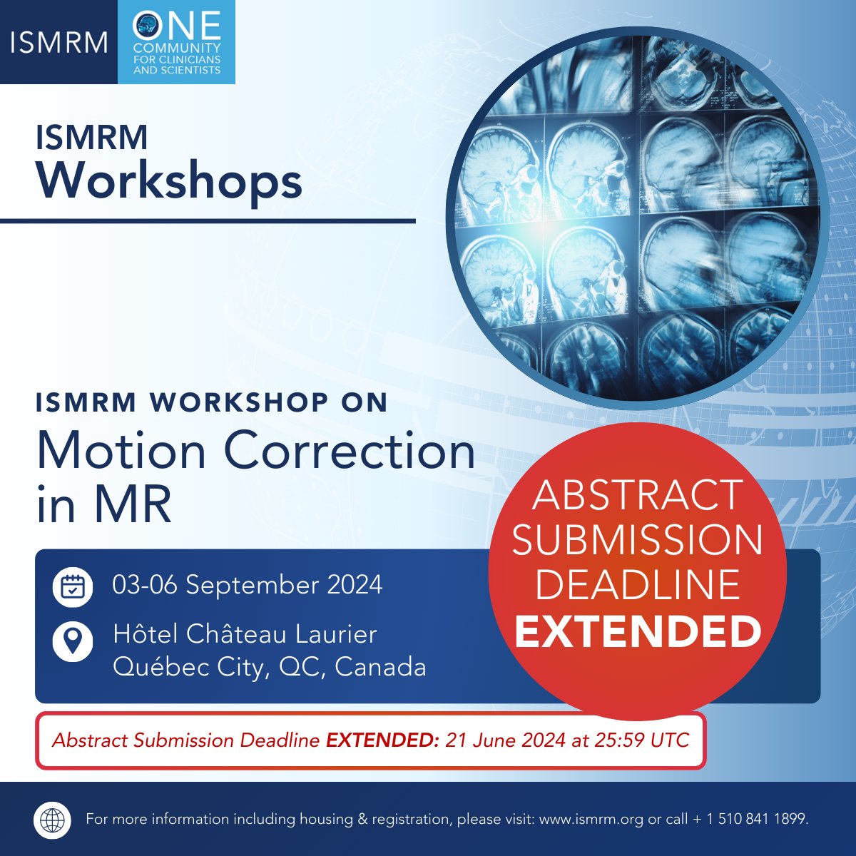 ISMRM's tweet photo. WORKSHOP WEDNESDAY:
48 hours until the abstract submission deadline for the ISMRM Workshop on Motion Correction in MR!

Submit yours by 21 June 2024 at 25:59 UTC: https://t.co/jlrspvtwa5

#ISMRM #ISMRT #MRI #MagneticResonance #MR #Radiology #MedicalImaging #MRIEducation https://t.co/t874osCpRc