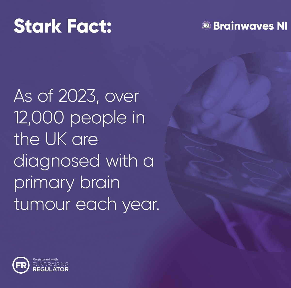 Brainwaves NI tweet media